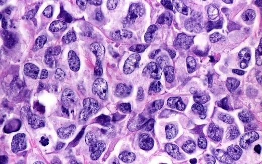 Microscopía Convencional